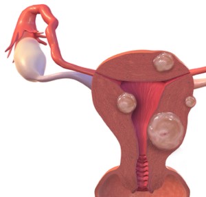 Auricular Acupuncture with TCM Formula Nearly Doubled IVF Conception Rates