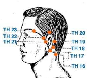 Bloodletting Found Effective For Migraines - no not "that" bloodletting...