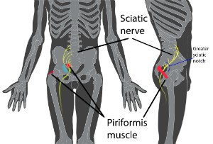Electroacupuncture Or Moxibustion Promote Sciatic Nerve Regeneration (Back Pain Study)