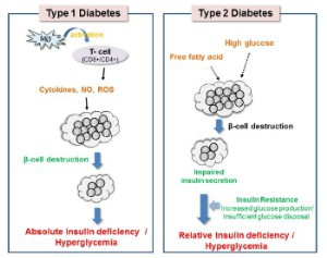 Study Finds Wu Mei Wan Herbal Formula Protects Pancreatic Beta Cells in Diabetes